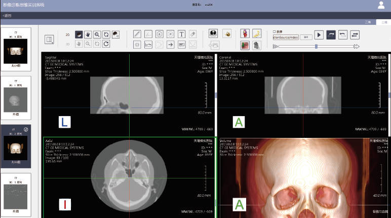 影像診斷思維實訓(xùn)系統(tǒng)